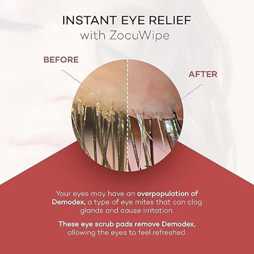 Zocular Zocuwipe Eyelid Wipes Eyelid Cleanser and Moisturizer Pads 30ct + Zocular ZocuZap Facial Wipes, 15 Count Bundle