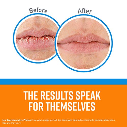Cooling Relief Lip Balm - Pack of 8, Hydrating Lip Moisturizer with Menthol