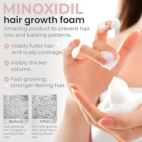 Women’s Minoxidil 5% Hair Regrowth Foam for Thinning Hair - Clinically Proven