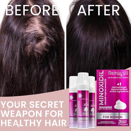 Women’s Minoxidil 5% Hair Regrowth Foam for Thinning Hair - Clinically Proven