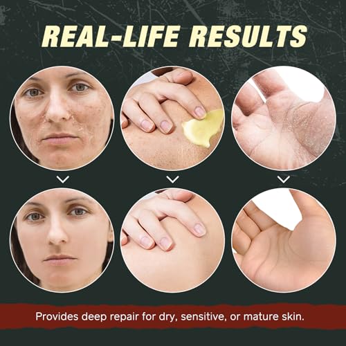 Beef Tallow Balm with Frankincense and Castor oil 4.2 fl.oz, 100% Grass-Fed Tallow for Skin Care, Face & Body Moisturizer for Skin Hydrating & Nourishing, Sensitive Skin & Dry Skin Age Defying