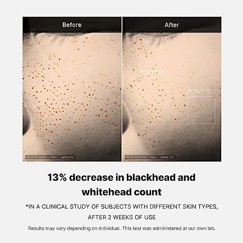 Overnight Pore Refining Serum with 15.2% AHA+BHA+PHA & Niacinamide - Reduce Pores & Blackheads