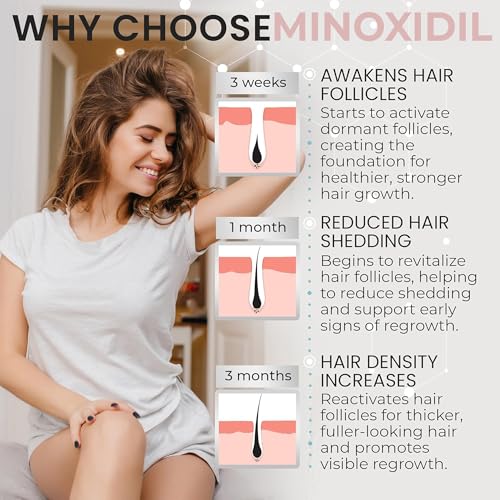 Women’s Minoxidil 5% Hair Regrowth Foam for Thinning Hair - Clinically Proven