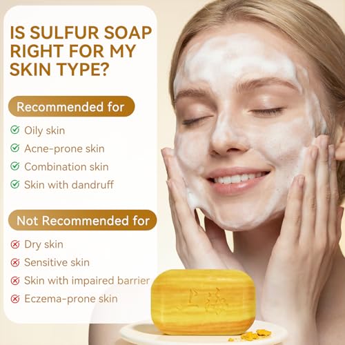 Sulfur Acne & Body Soap Bar 10% - Pack of 6, Face & Skin Treatment