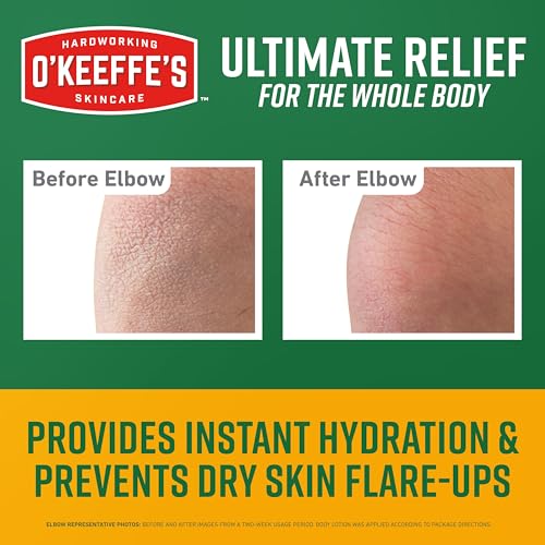 O¡¯Keeffe¡¯s Skin Repair Ultimate Relief Body Cream, 7oz Tube (Pack of 1) ? for The Most Severe Dry Skin