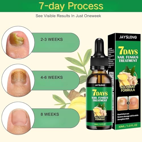 7 days Nail Treatment, Ginger Nail Treatment, Nail Nutrient Oil Strengthener Oil