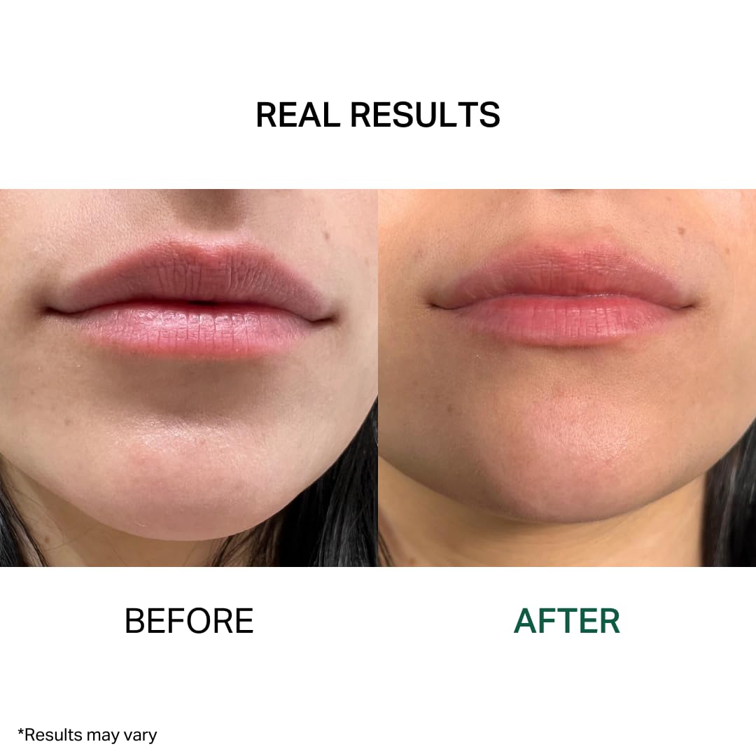 Y’OUR Intensive Healing Lip Balm & Overnight Lip Mask | Instantly Relieves & Repairs Dry, Chapped Lips | Deeply Hydrating Formula with Shea Butter & Rosehip Oil | Lightweight, Paraben & Silicon-Free