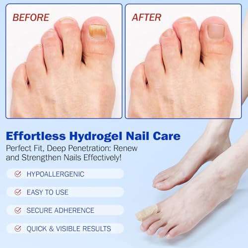 Lothee 120 Pcs Nail Clippers and Nail File Sets Bulk for Men Women 60 Pcs Thick Stainless Steel Fingernail and Toenail Cutter Clippers 60 Mini Double Sided Emery Board Manicure Pedicure Beauty Salon