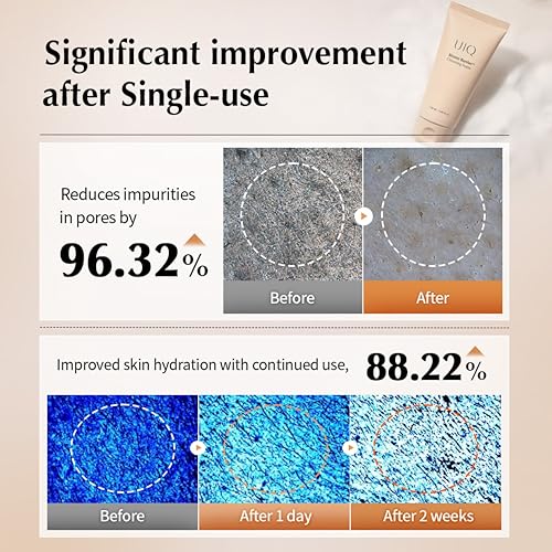UIQ Biome Barrier Cleansing Foam, Facial Cleanser, Mild Hypoallergenic formula, Face Wash, Blackhead Remover, Moisturizing facial cleanser for All Skin Types 4.05 fl.oz(120ml)