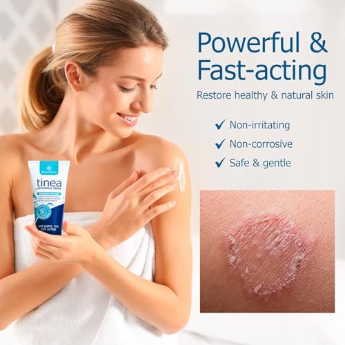 RoyceDerm Miconazole 2% Antifungal Cream Pack of 2 for Tinea, Athlete’s Foot & Ringworm