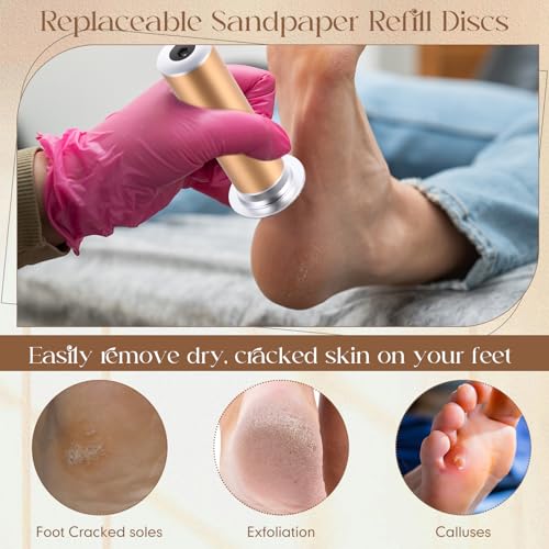 Electric Foot File Replacement Disc 80 Grit for Callus Removal - Pack of 500 - Suitable for Men & Women