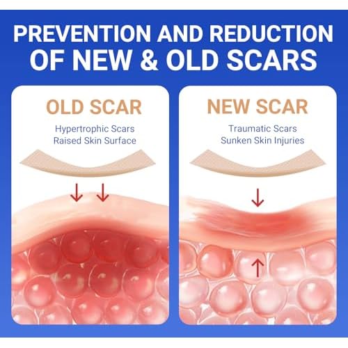 Silicone Scar Sheets Surgical Tape (1.6¡±x120¡± Roll) Face Patches Acne Treatment C Section Strips, Skin-Sensitive Medical Grade Healing Scar Bandages Pads for Keloid, Stretch and Tummy Tuck Recovery