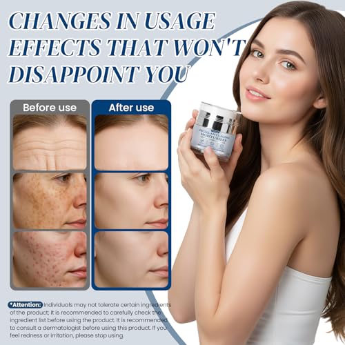 Aunpoos Retinol Collagen Face Cream for Anti-Aging, Tightening & Hydration 2 Pack 1.7 fl oz