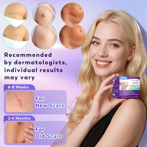 Silicone Scar Sheets, Silicone Scar Tape(1.6"x 120" Roll-3M), Medical Grade Scar Sheets, Scar Tape for Surgical Scars, Burn, C-Section, Keloid Scars, Acne Treatment, Stretch Marks Removal