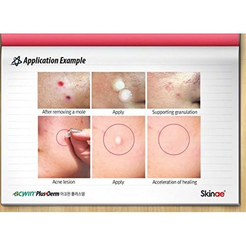 Acwin Plus Derm 3 Pack Acne Spot Pimple Absorbing Cover Patch, Moist Wound Dressing for Skin Trouble Acne Pimple Care Hydrocolloid Patch (Total 204 count)