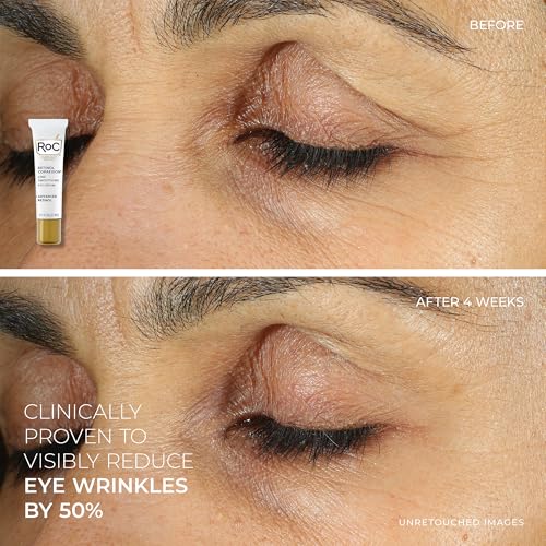 Retinol Eye Cream Serum Capsules & Hydrating Night & Day Cream Set for Anti-Aging