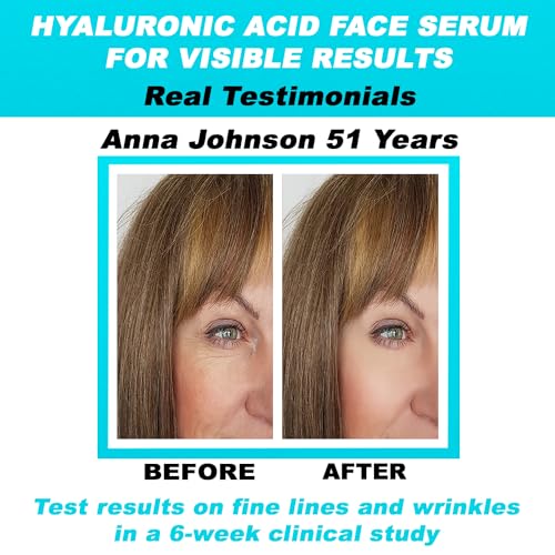 Pure Hyaluronic Acid Serum for Face Anti Aging, Fine Lines, Dark Spots, & Dry Skin 2 oz
