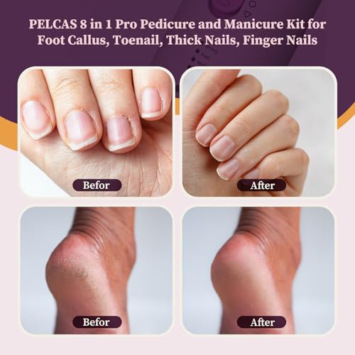 Pelcas Toenail Grinder for Thick Nails - Pink 8-in-1 Pedicure & Manicure Kit