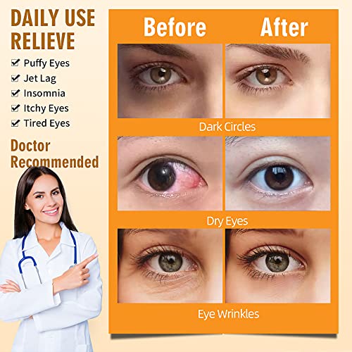 Serfeymi 10 Packs Steam Eye Masks,Disposable Self Heated Warm SPA Moist Eye Mask Compress Pad for Sleeping,Eye Fatigue Relief,Christmas Stocking Stuffers - Upgraded Scent-Chamomile