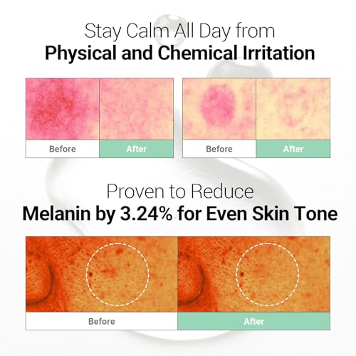 Soothing Calming Ampoule with Niacinamide Hyaluronic Acid CICA for Sensitive Skin