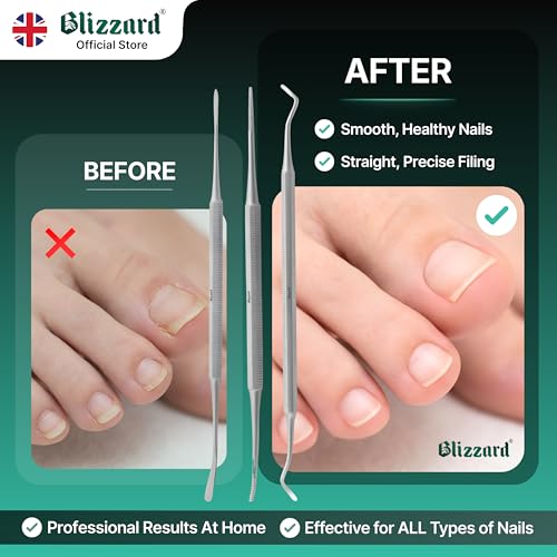 Ingrown Toenail File Set by Blizzard ? 3 Piece Double-Ended Tool Kit with Blacks File, Nail Cleaner and Lifter for Cleaning and Care of Ingrown Toenails - Premium Stainless Steel