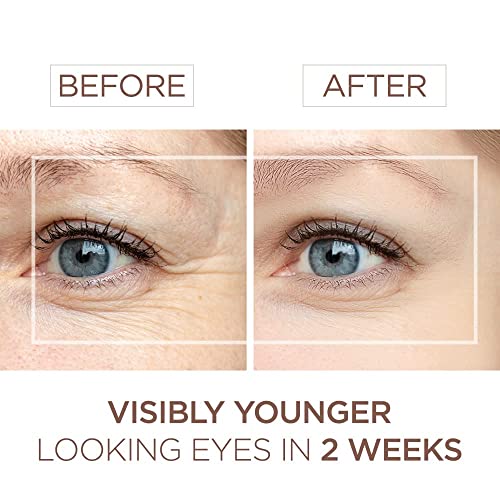Natural Eye Serum for Dark Circles & Puffiness - Anti-Aging & Wrinkle Treatment 15ml