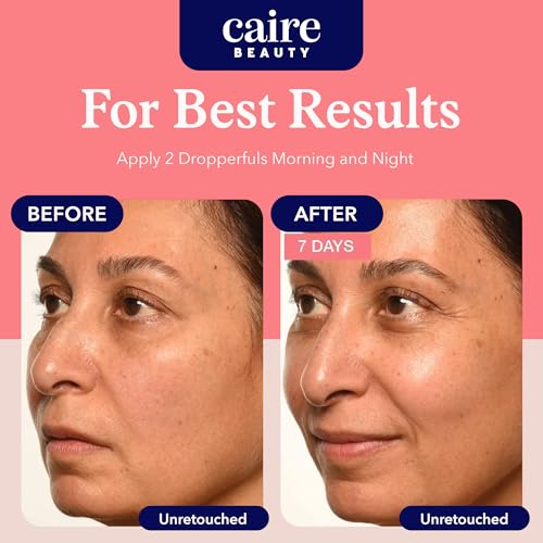 Caire Hyaluronic Acid Collagen Serum 0.51 Fl Oz - Age-Defying Skin Rejuvenation