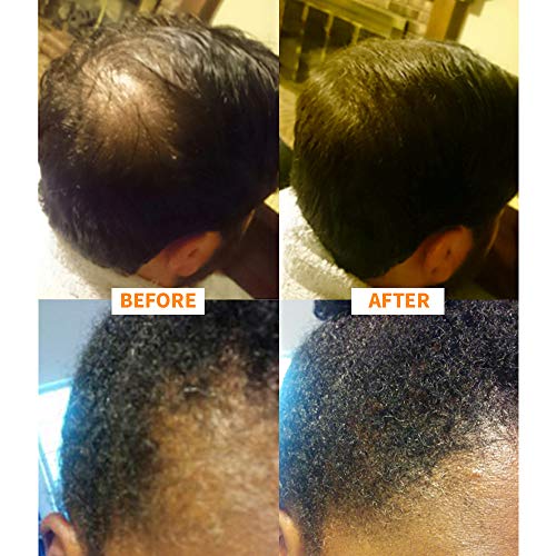Nor1 Auburn Keratin Hair Building Fibers - Thicker, Fuller Hair Concealer for Men & Women