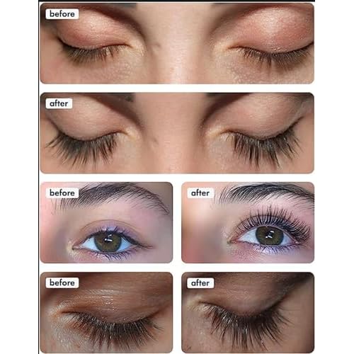 TOPLASH XL Lash and Brow Booster, Growth Serum with Eyelash and Eyebrow Enhancer, Promotes Stronger, Thicker, Healthier Lashes with Botanicals and Peptides - 0,2 Fl Oz(6 ml)