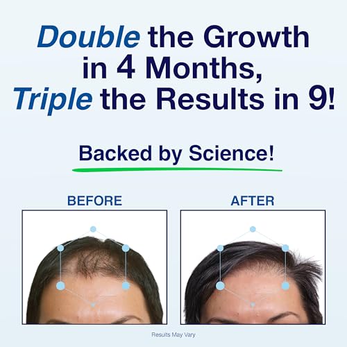 Patented Hair Growth Vitamins for Women & Men | Clinically Proven