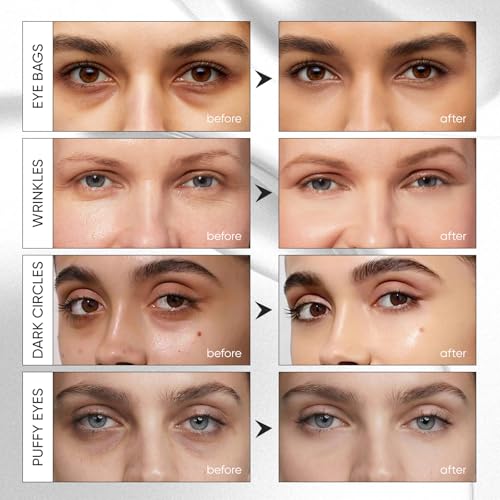 Instalift PDRN & Collagen Eye Patches, Under Eye Patches for Puffy Eyes and Dark Circles & Fine Lines, with Niacinamide, Hydrolyzed Collagen, Deep Moisturizing £¦ Soothing Eye Mask, 24 Pairs