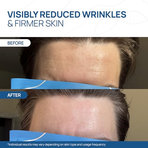 Welaroise Collagen Hydrogel Mask 5 Pack - Deep Hydration Korean Skin Care