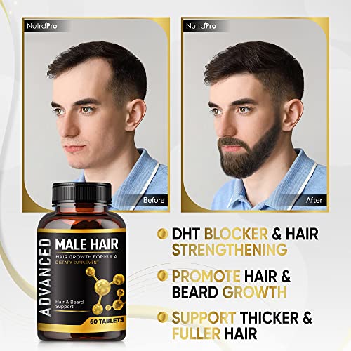 Men's Hair Growth Vitamins - Supports Thicker, Fuller Hair & Beard - DHT Blocker & Biotin Supplement