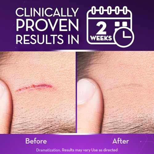 Cicatricure Advanced Scar Gel 2 oz - Proven Results in 2 Weeks - Pack of 1