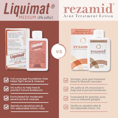 Acne Spot Treatment Lotion with Sulfur & Resorcinol for Oily Skin - 2oz