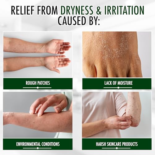 GLY MIRACLE Fragrance-Free Non-Greasy Body Lotion, 16 oz High-Glycerin Moisturizer for Sensitive, Extremely Dry Skin, Hands, Feet & Body