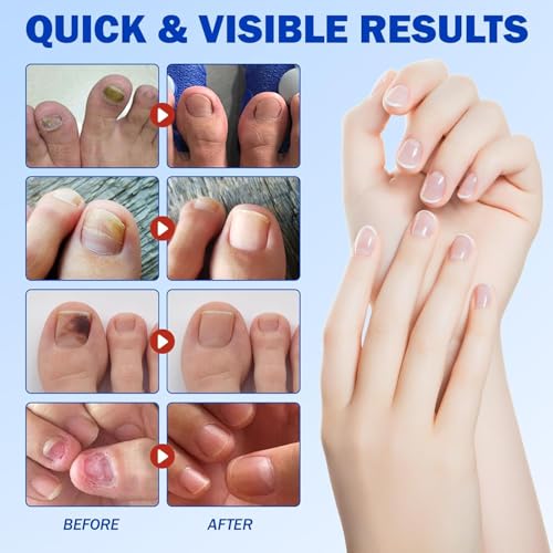 Murchison-Hume Velvet Glove Hand Cream with nourishing Fruit Extracts and Plant Seed Oils for lasting, 24-hour protection against dryness, non-greasy, Original Fig