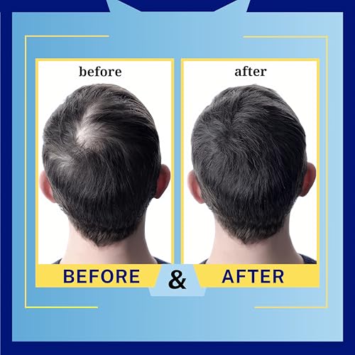 Moisturizing Dry Scalp & Hair Shampoo - Hydrating Sulfate-Free Formula 8.45 oz