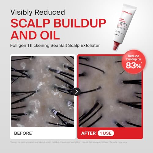 Scalp Care Kit for Hair Thinning & Loss - Travel Size 4-Step System
