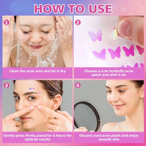 Acne Pimple Patches for Face (160 Counts), Hydrocolloid Acne Patches with Tea Tree Oil and Calendula Extract, Cute Colorful Butterfly Shape Spot Stickers for Skin Care, Zit Patches
