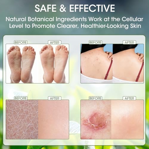 Natural Tea Tree Soap Bar, 3-Piece Set, Plant-Based Formula with Tea Tree & Coconut Oil, Purifying Cleanser for Face & Body, Refreshing & Gentle for Daily Use