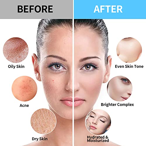 Jelly Face Mask For Facials | Bundle of 24K Gold & Vampire+ Hyaluronic Acid Hydrating And Brightening HydroJelly Masks | Vajacial