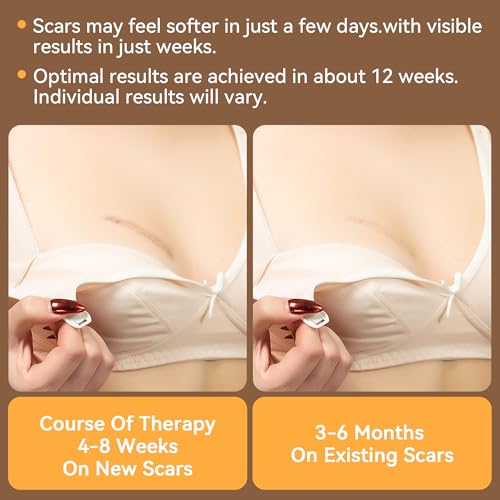 Including 8 Areola Soft Strips & 4 Anchor Sheets, Silicone Scar Sheets for Breast - Medical Grade Breast Silicone Scar Tape Patches for Surgical Scars