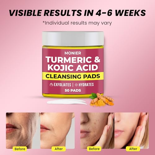 Turmeric Kojic Acid Cleansing Pads for Face Dark Spots - Hydrates & Plumps Skin - With Vitamin C & E - Sensitive Skin Friendly (50 Pads)