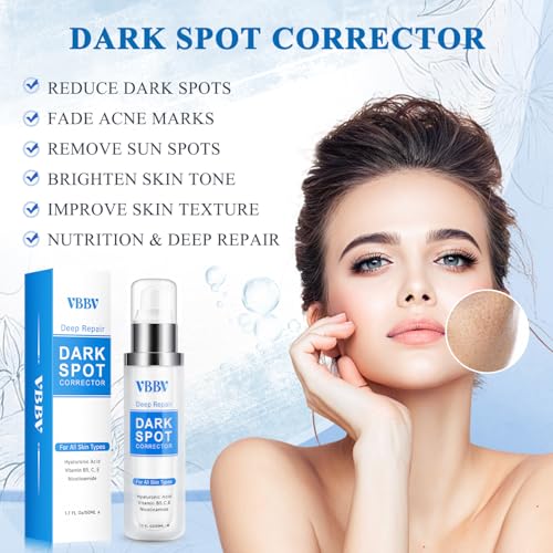 Dark Spot Remover for Face and Body, Dark Spot Corrector, Sun Spot Freckles Hyperpigmentation Treatment, Advanced Dark Spot Remover Cream with Niacinamide for Women and Men (1.7 Fl Oz)
