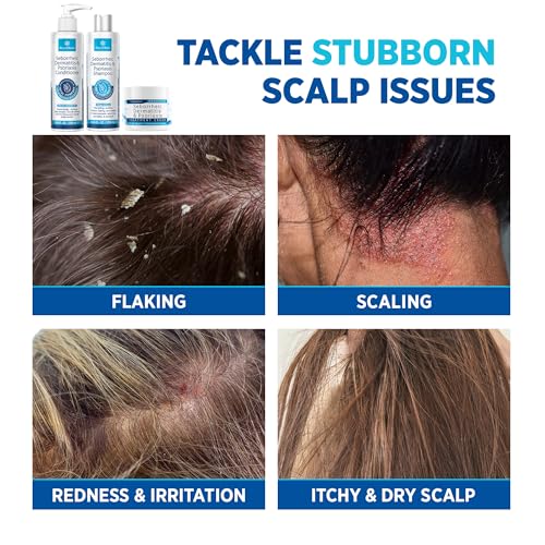 Seborrheic Dermatitis & Psoriasis Cream, Shampoo & Conditioner Set - Scalp Relief