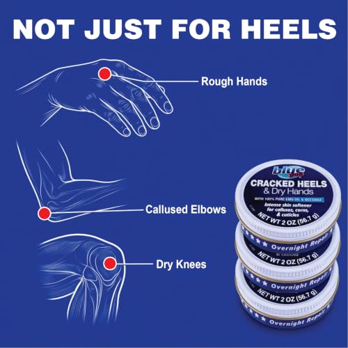 Blue Goo Cracked Heels & Dry Hands Skin Protectant 2 oz - Pack of 3