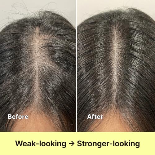 Black Grain Strengthening Shampoo for Thinning Hair 16.9 fl oz - Volumizing & Scalp Care