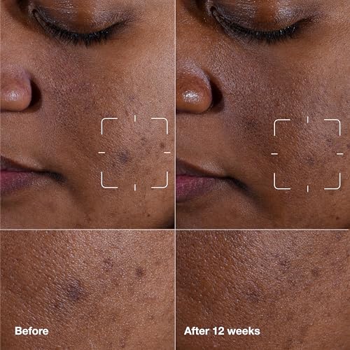 Clinique Even Better Clinical Dark Spot Clearing Vitamin C Face Serum - Mini Travel Size 1 Fl Oz