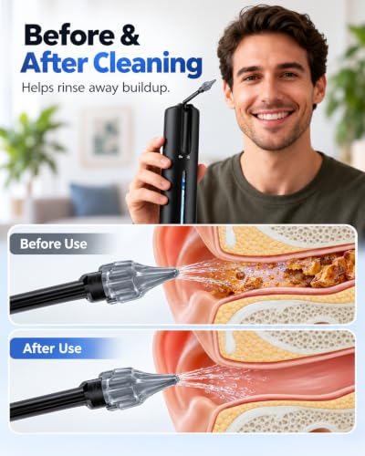 Electric Ear Wax Removal Kit Black, 4 Modes, 10 Nozzles, Waterproof